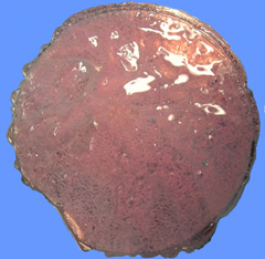 photograph of encapsulated islets
